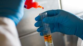 在化学实验区，一双戴着手套的手正从一个挤压瓶中向一个装有透明物质的烧瓶中加入橙色液体.